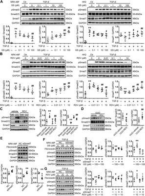 Remdesivir Inhibits Tubulointerstitial Fibrosis in Obstructed Kidneys